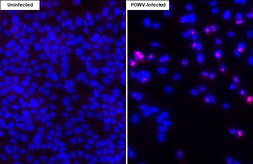 Anti-Powassan virus Capsid antibody [HL4303] used in Immunocytochemistry/ Immunofluorescence (ICC/IF). GTX643543